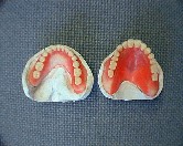 総入れ歯（全部床義歯）の作り方│一般社団法人 広島県歯科技工士会